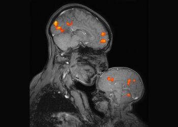 MIT’s McGovern Institute is shaping brain science and improving human lives on a global scale | MIT News
